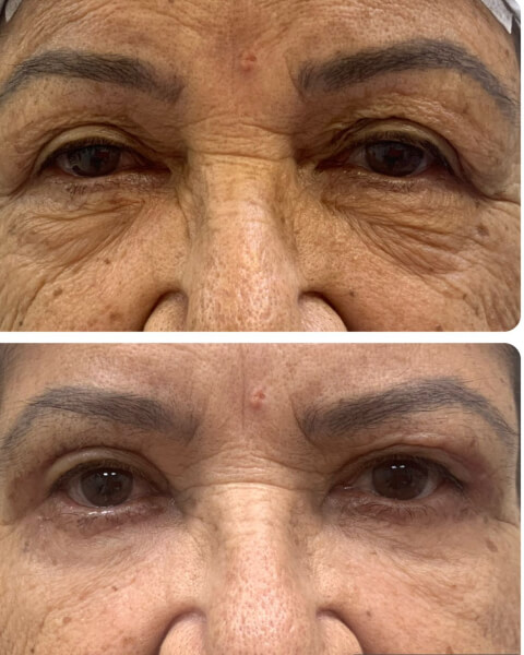 Resultado Dra Sulamita 11