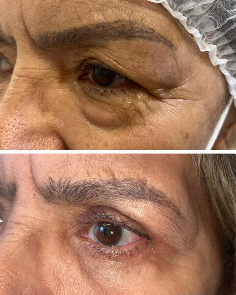 Resultado Dra Sulamita 12