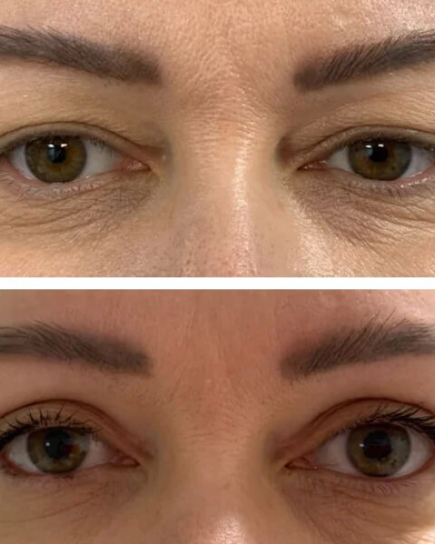 Resultado Dra Sulamita 22