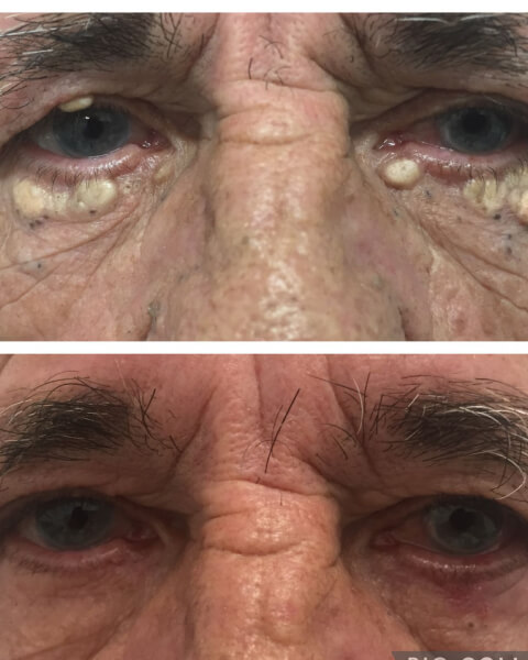 Resultado Dra Sulamita 3