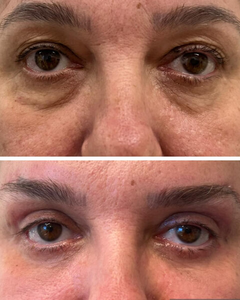 Resultado Dra Sulamita 4