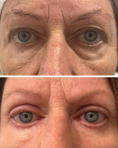 Resultado Dra Sulamita 5