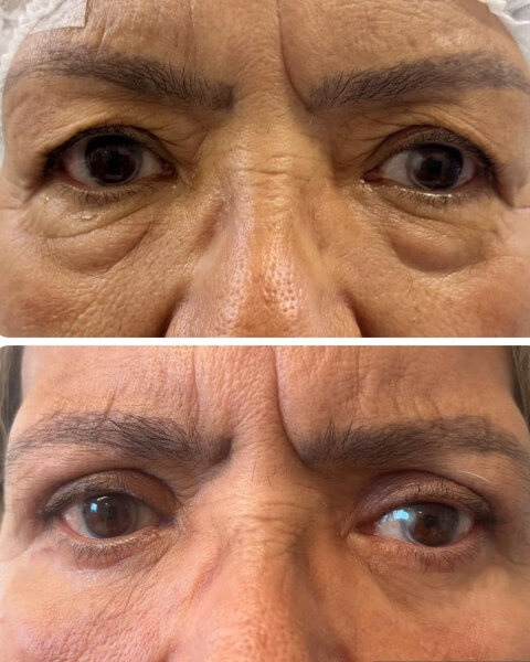 Resultado Dra Sulamita 6