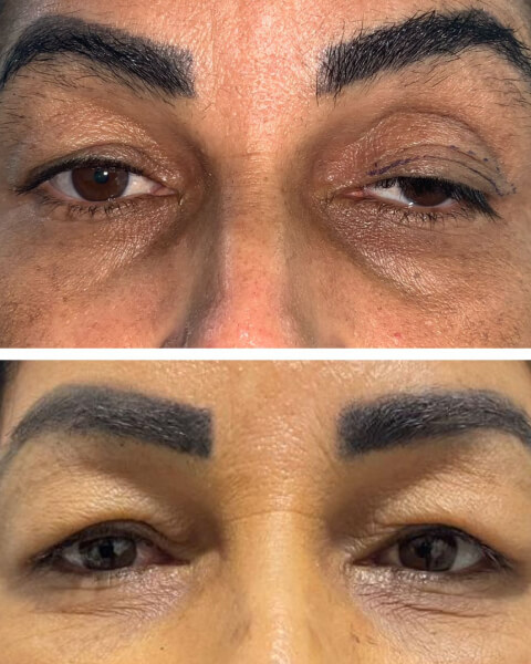 Resultado Dra Sulamita 7