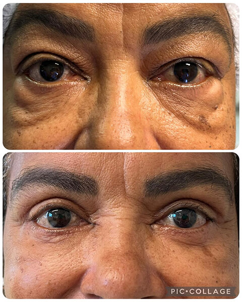 Resultado Dra Sulamita 13 (1)