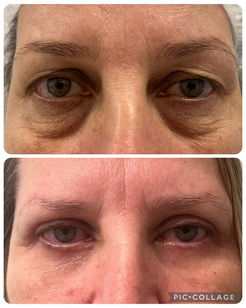 Resultado Dra Sulamita 14 (1)