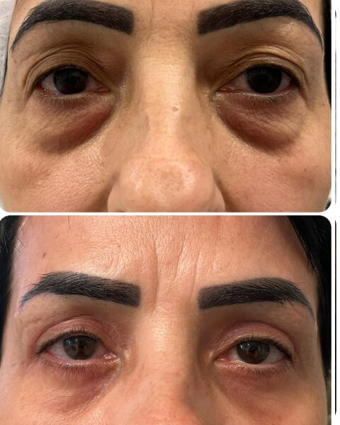 Resultado Dra Sulamita 18 (1)