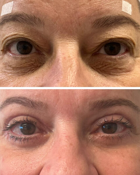 Resultado Dra Sulamita 19 (1)